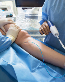 Krampfaderbehandlung