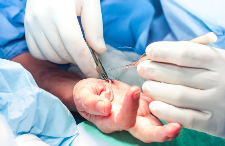 Handchirurgie