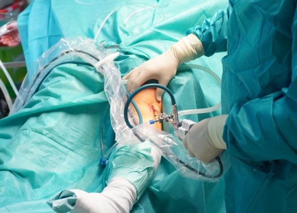 Arthroskopische Operationen