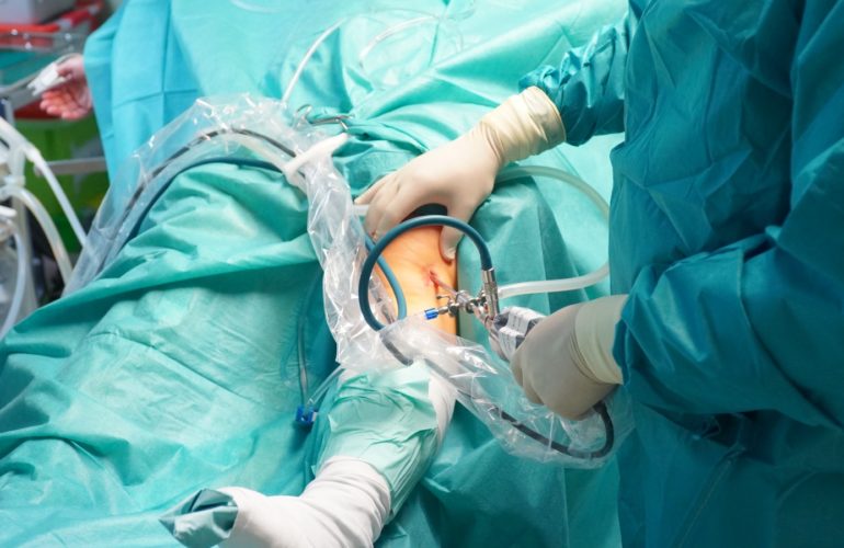 Arthroskopische Operationen